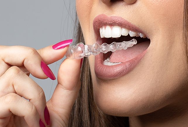 Paciente colocando alinhador invisível New Aligner