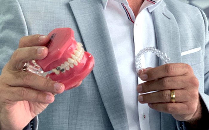 Dr. Claudio Figueiredo com modelo dental e alinhador, apresentando o TOHi